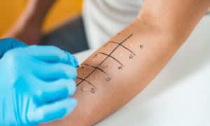 5 answers about adult-onset food allergies