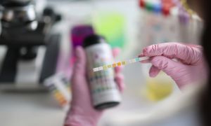 IgA nephropathy: understanding proteinuria