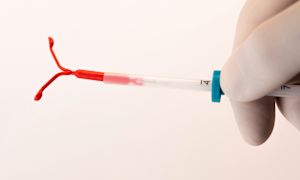 5 things to know about intrauterine devices (IUDs)