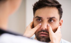 Nasal polyps: 5 questions for your healthcare provider