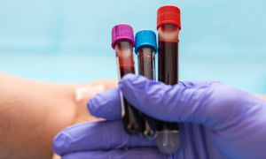 What are the less common types of anemia?