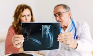 Understanding parathyroid hormone and hypoparathyroidism