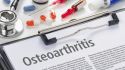 Osteoarthritis symptoms journal