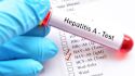 What to know about hepatitis A