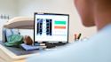 Should you be screened for osteoporosis?