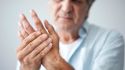 5 frequently asked questions about rheumatoid arthritis flares