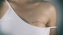 What type of surgery is used to treat breast cancer?