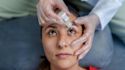 Everything you need to know about dry eye flares