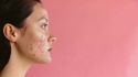 Understanding types of acne and acne severity