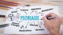 6 psoriasis topics to discuss with your healthcare provider