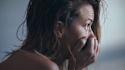 How psoriasis affects body image