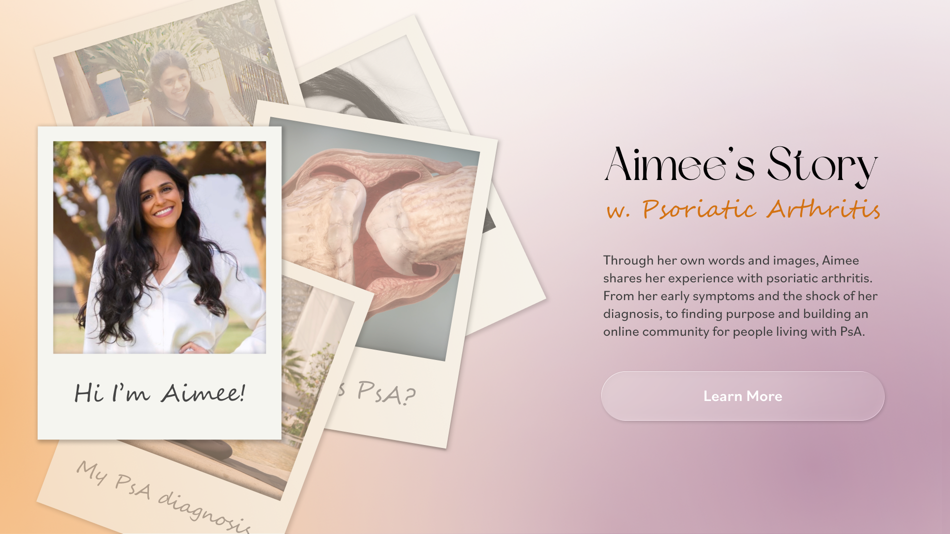 Interactive Patient Journey My Story - Psoriatic Arthritis