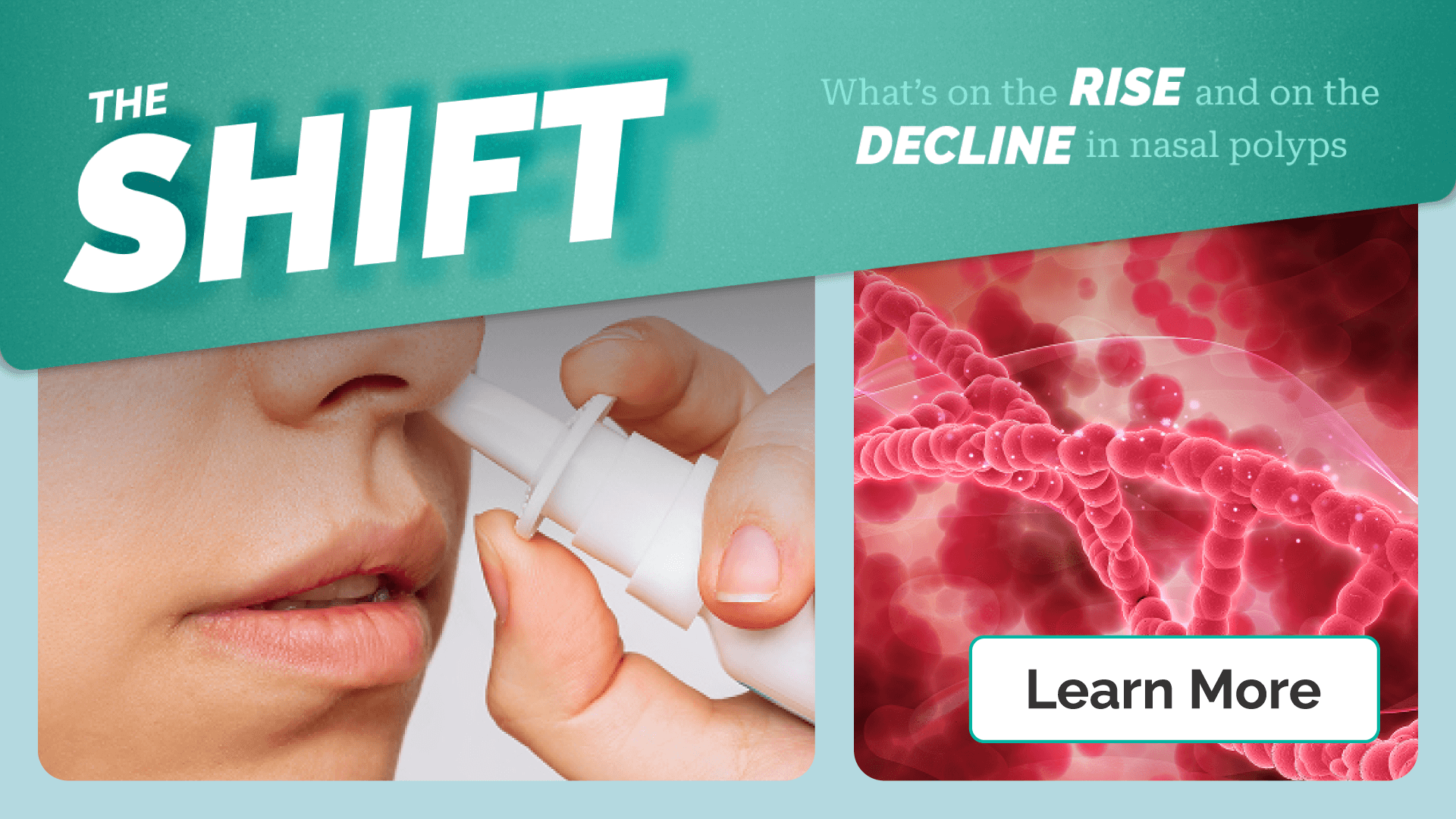 The Shift: Nasal Polyps