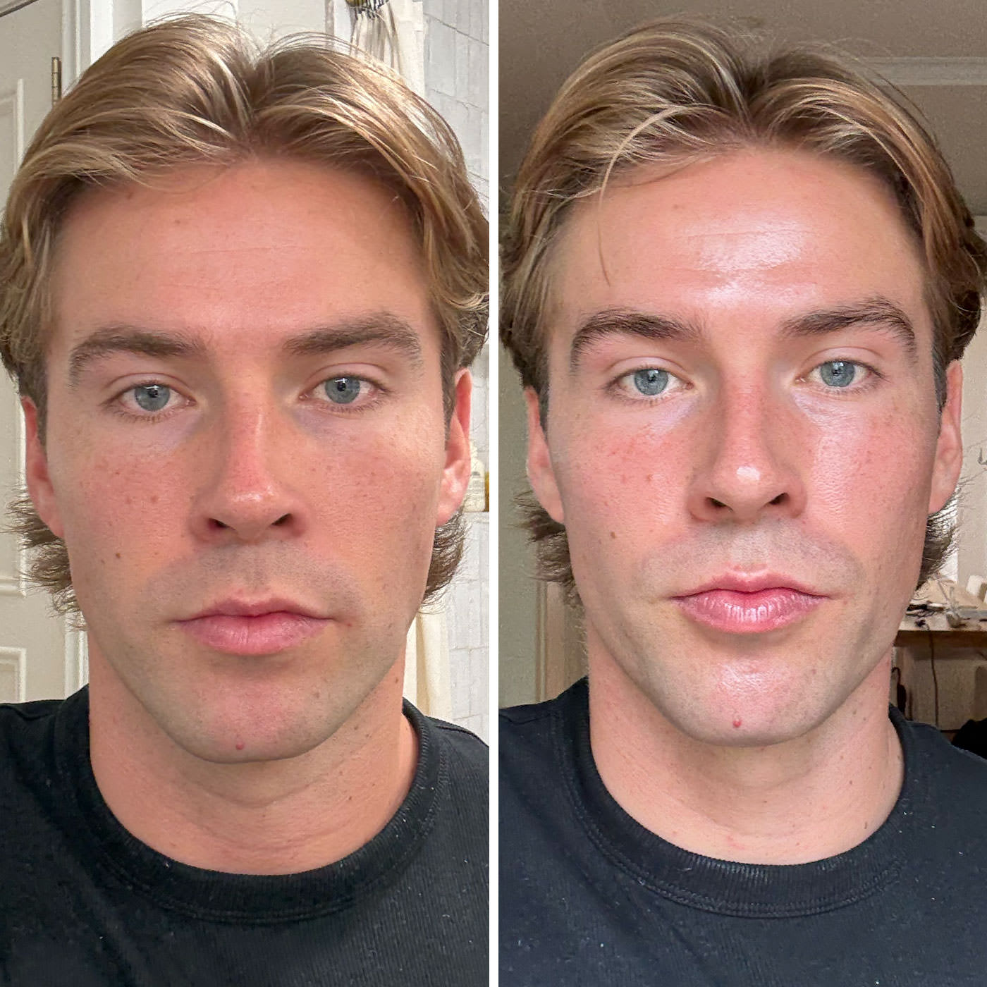 Before-and-after photos of a man with short light brown hair wearing a black t-shirt, showing changes in skin tone and texture with a more even, hydrated complexion.