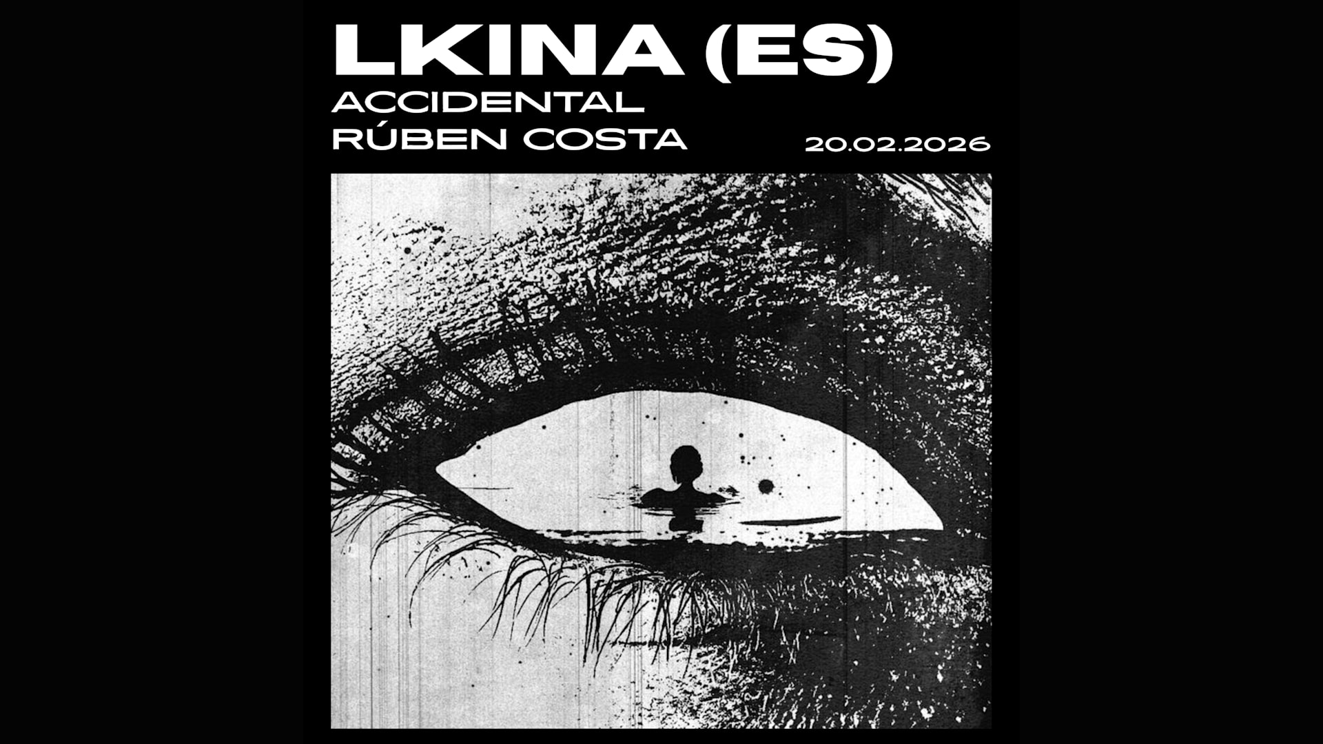Lkina (Es) + Accidental + Rúben Costa Cover