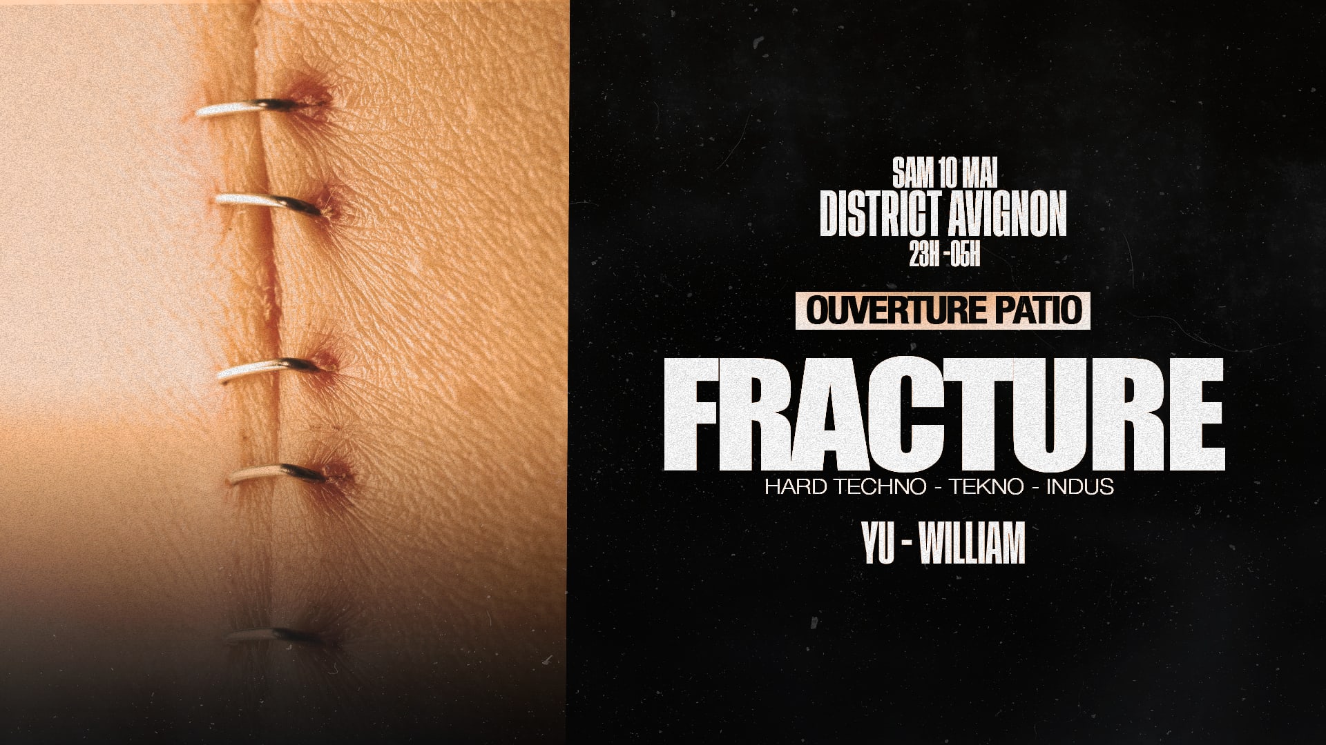 Fracture : Yu - William (Ouverture Du Patio) Cover