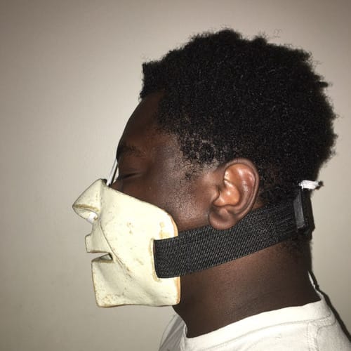 Etienne The Antidote