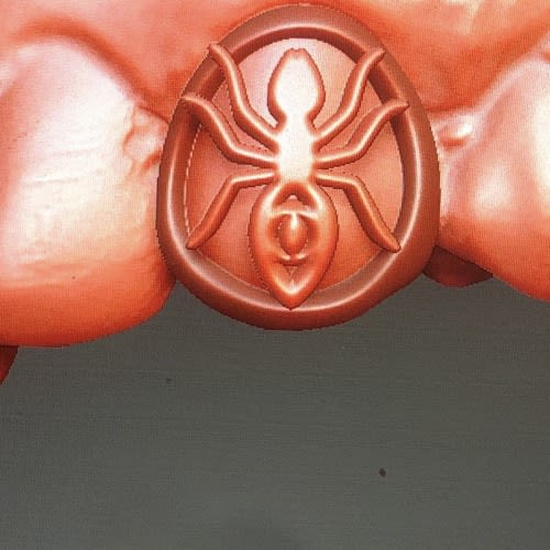 Antz