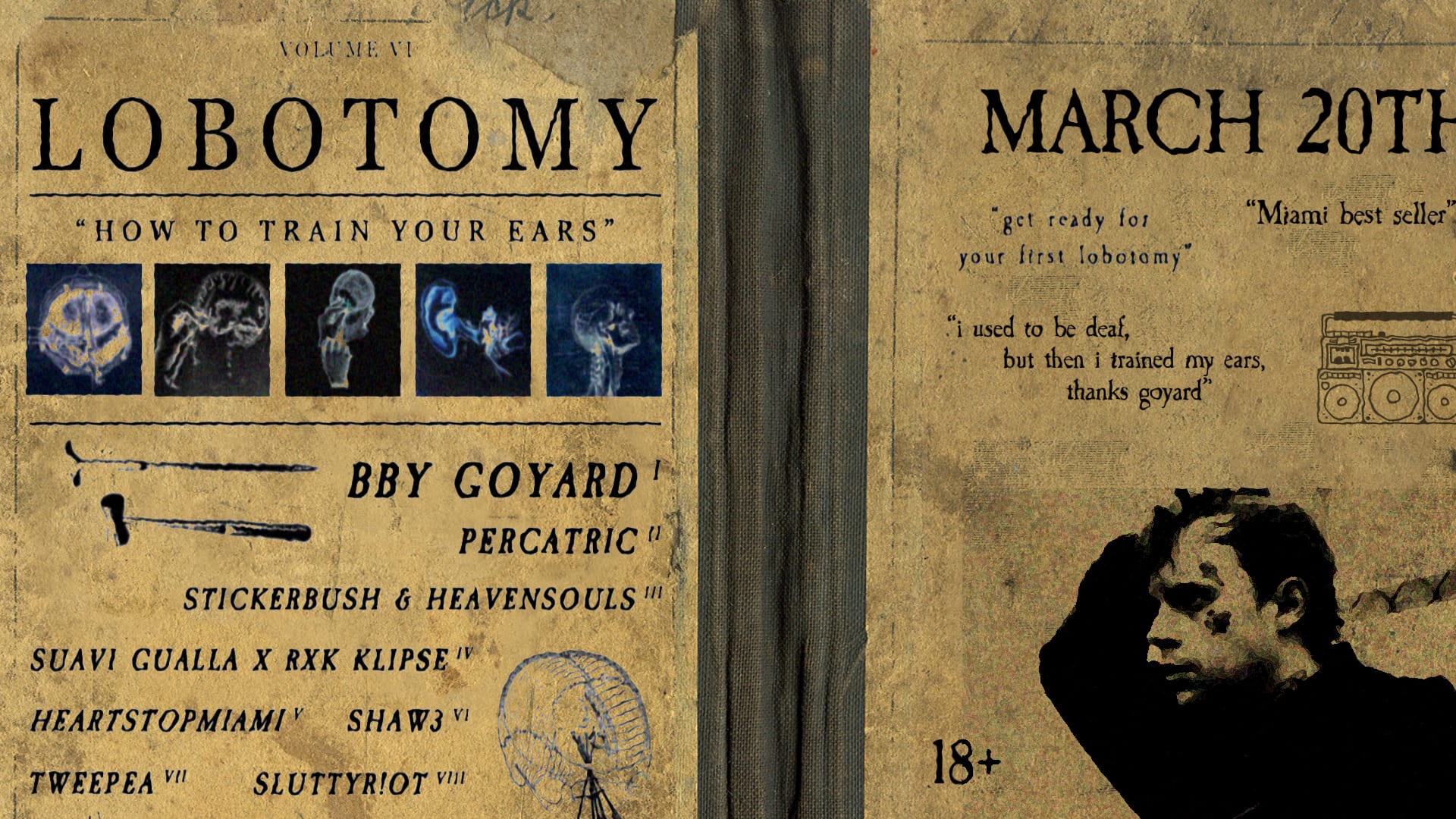 Lobotomy | Bby Goyard