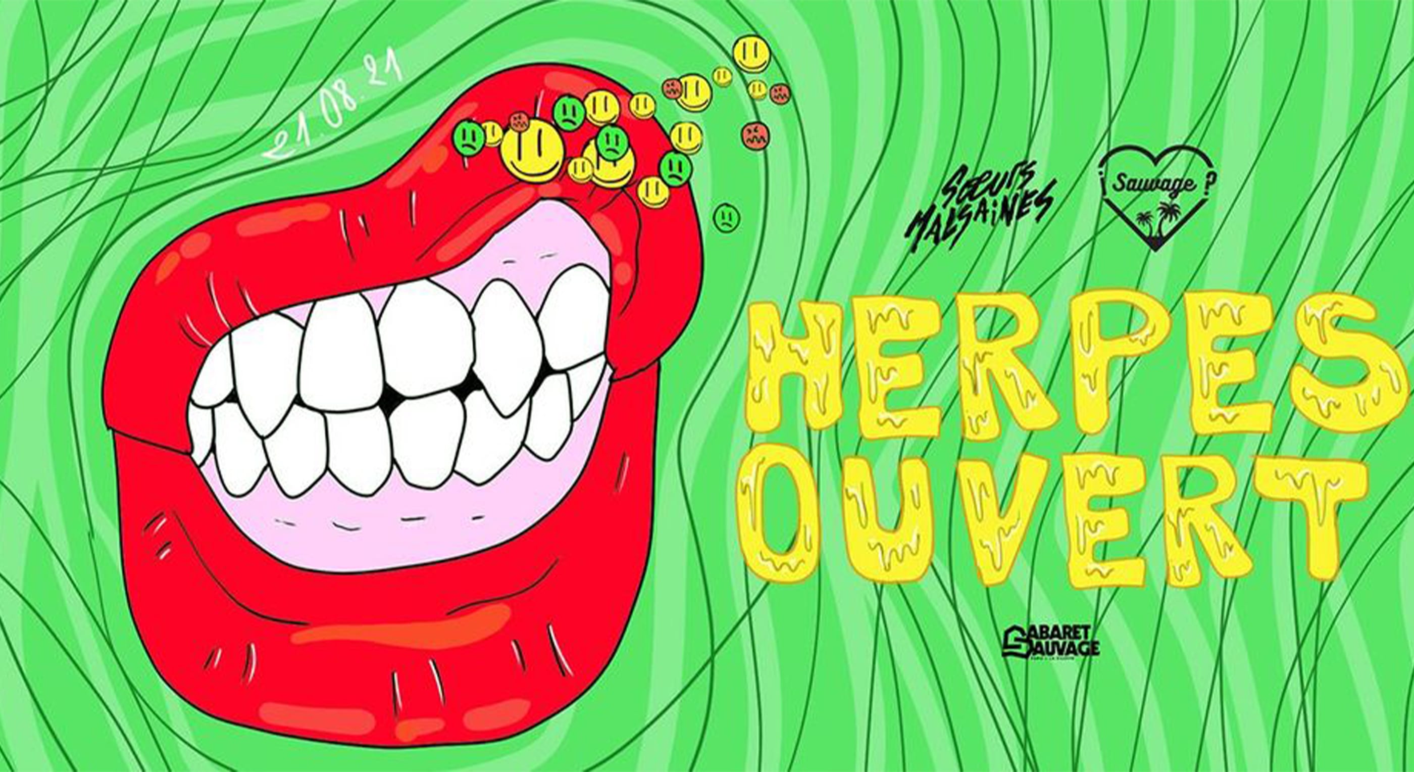 ¡Herpes Ouvert? La Rechute
