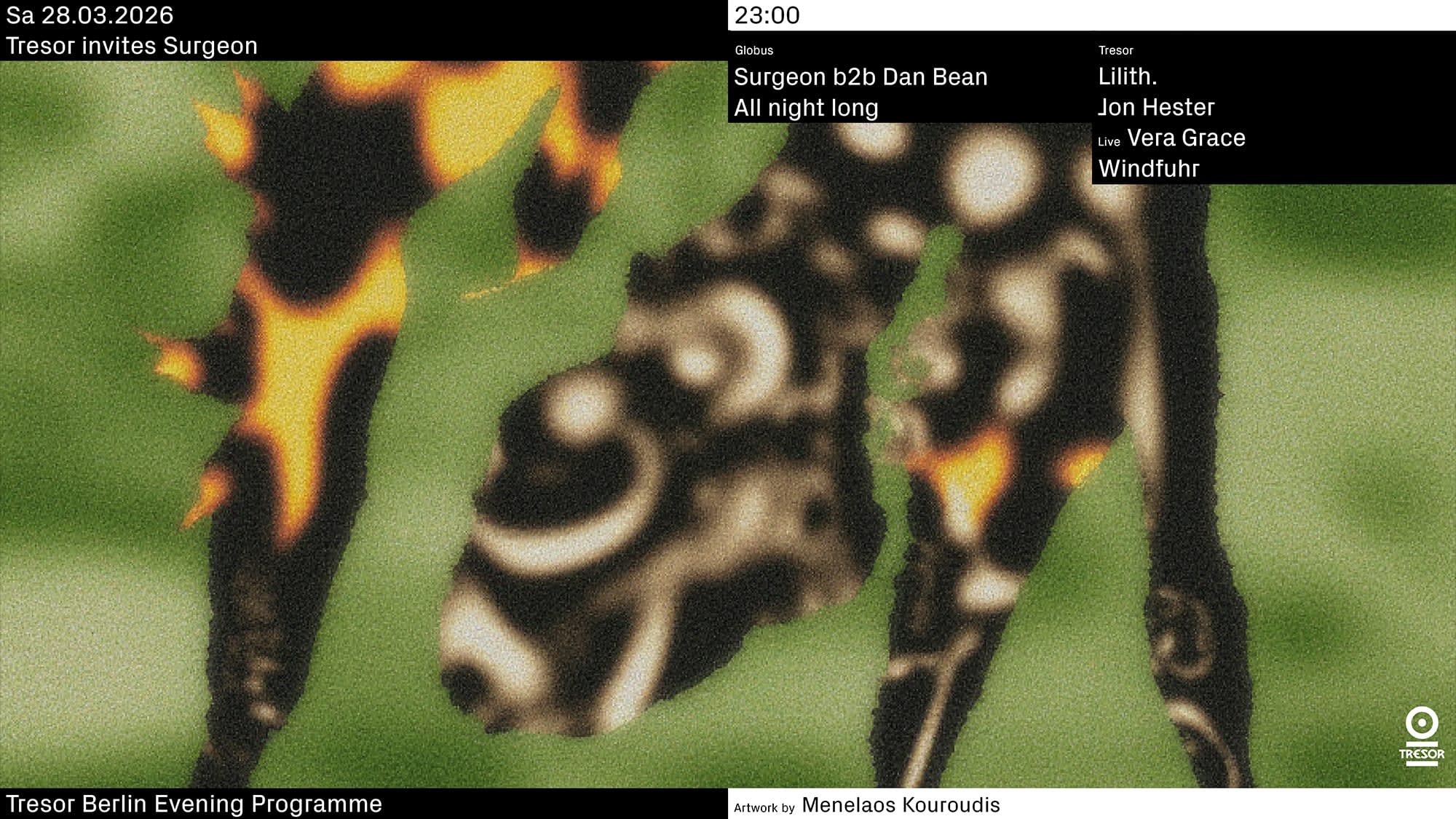 Tresor Invites Surgeon