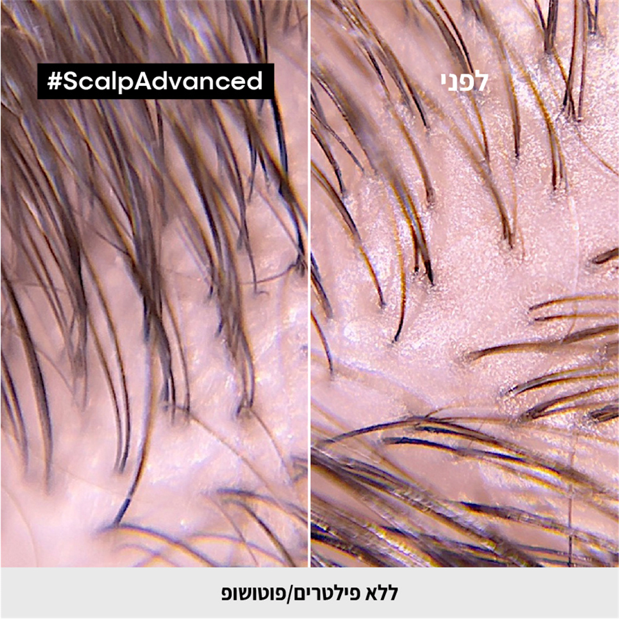 סקלפ מסכת חימר 2 ב-1