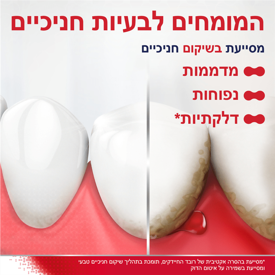 פרדונטקס שיקום חניכיים