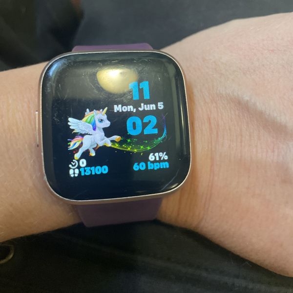 User uploaded image of Fitbit Versa