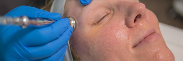 Microdermabrasion Service at BodyBrite Spa BodyBrite Spa Microdermabrasion