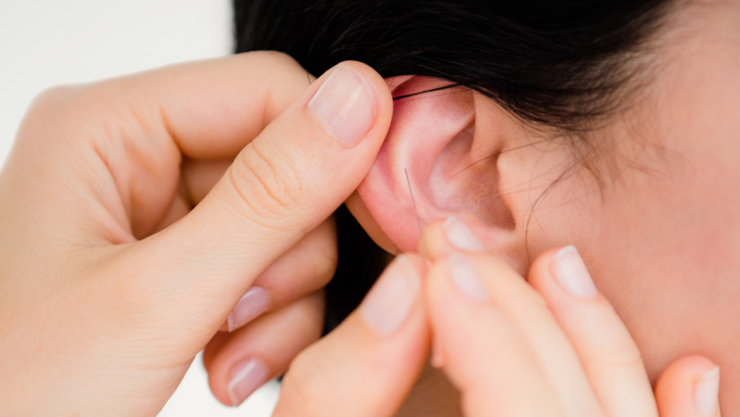 Auricular Acupuncture oesmfd