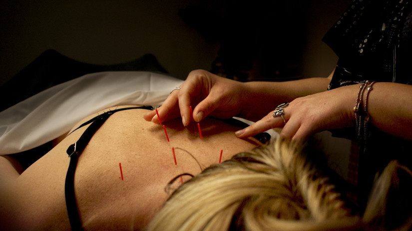 Acupuncture Therapy