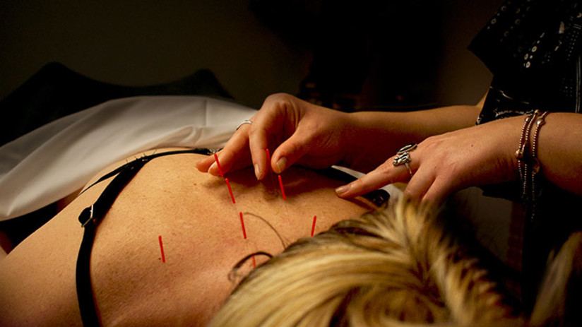 program acupuncture