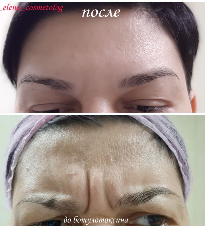 pro-Елена-Новикова-in-lakki-crm