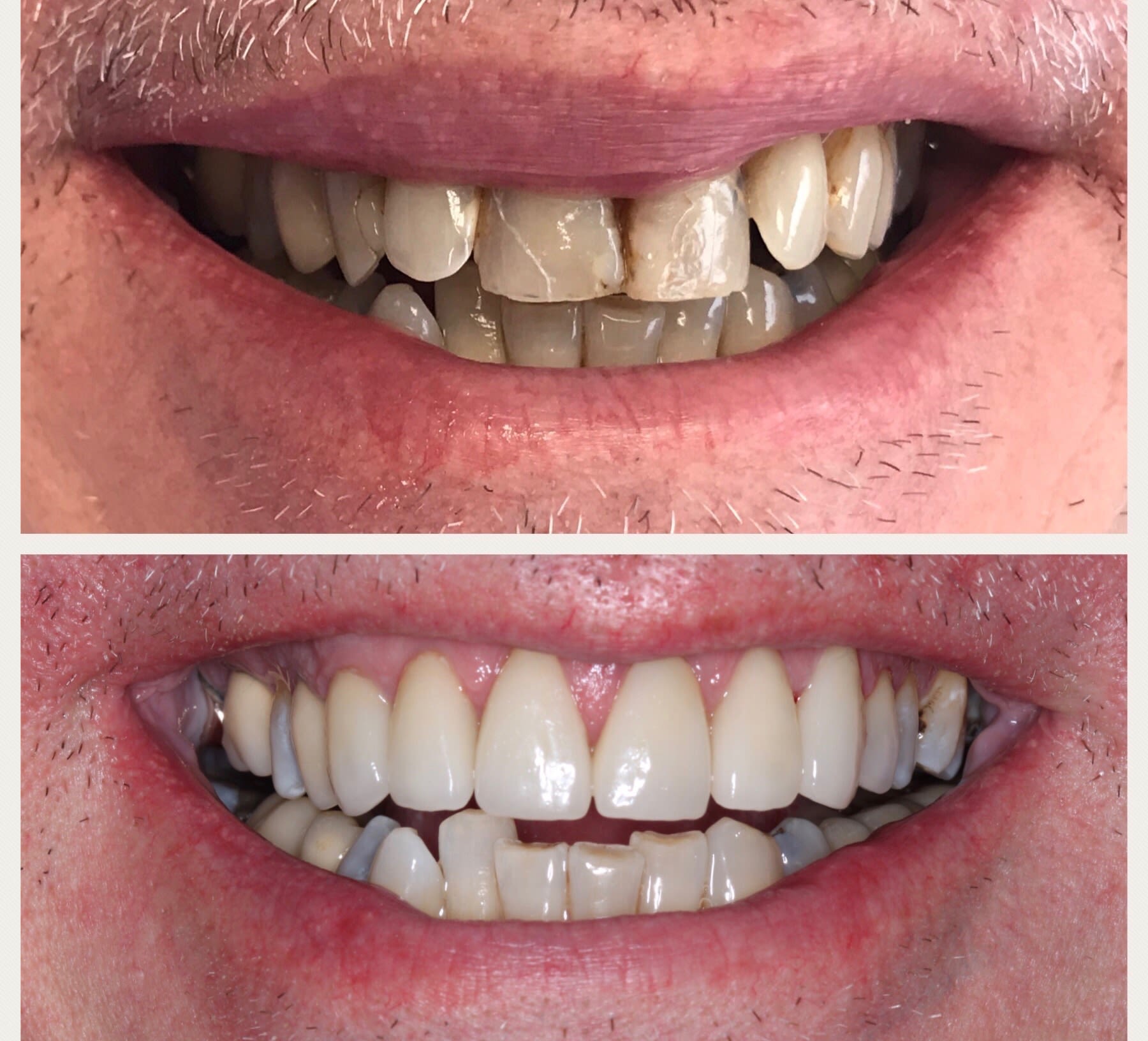 12+ Incredible Top Aesthetic Dentist Nyc Ideas