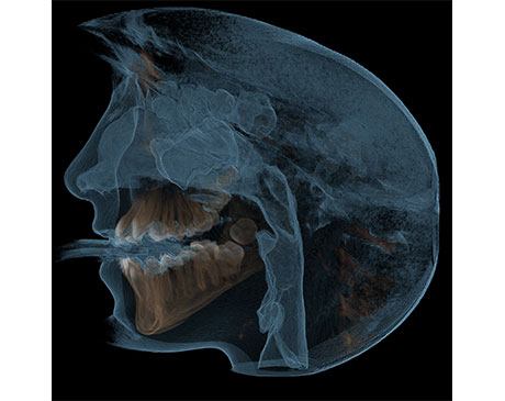 Side Shot of the Human Jaw