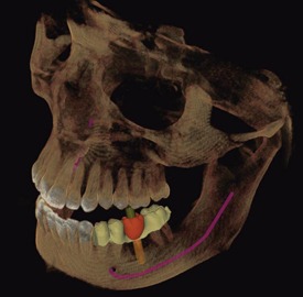 3D Scan Results Front