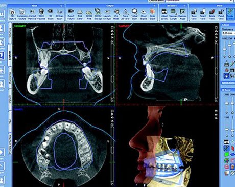 Examination of the Human Jaw