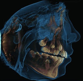 3D Scan Results Side