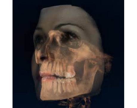 Jaw Bone Examination
