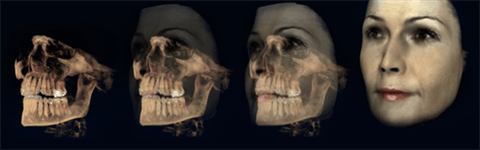 Skull Transform Image