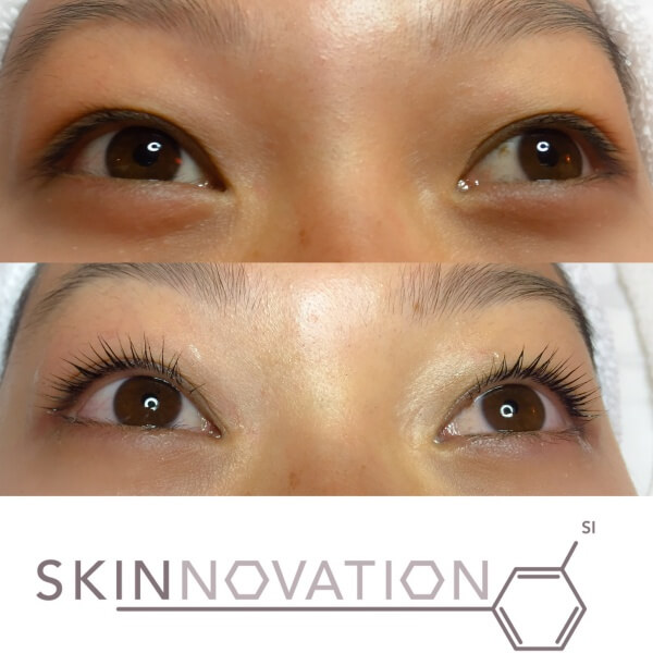 Skinnovation