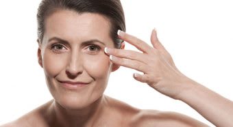 Woman showing crows feet before getting treated by Botox.
