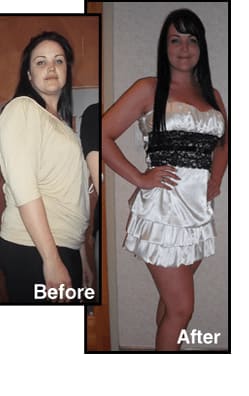 Lose weight too fast loose skin photo 4