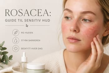 Rosacea: hva det er og hvordan du kan ta vare på sensitiv hud