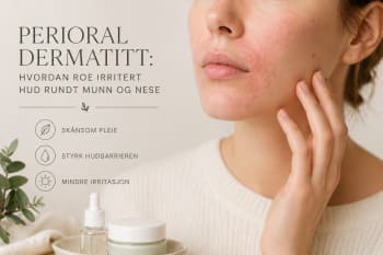 Perioral dermatitt: hva det er og hvordan du roer huden