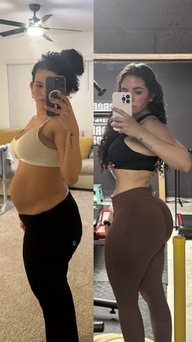 Mommy Makeover