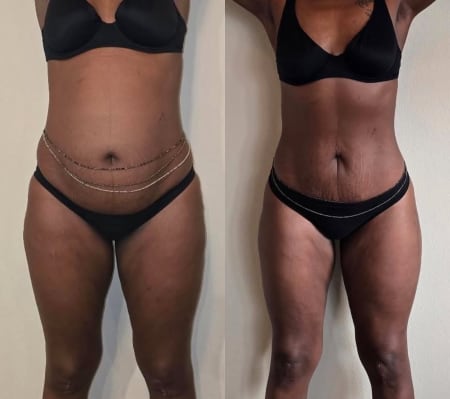 Membership transformation testimonial by Client Transformation