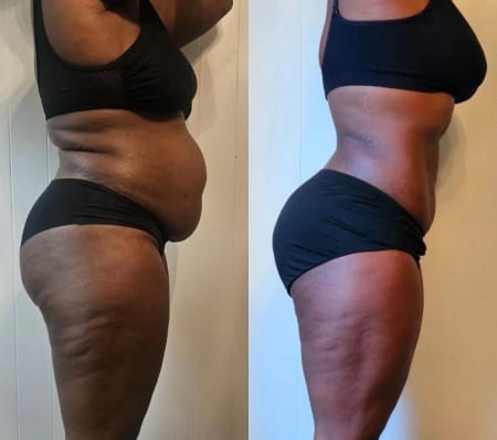Membership transformation testimonial by Client Transformation