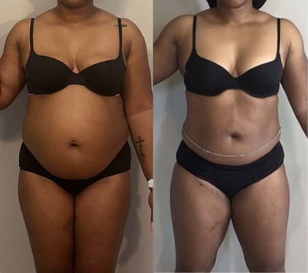 Membership transformation testimonial by Client Transformation