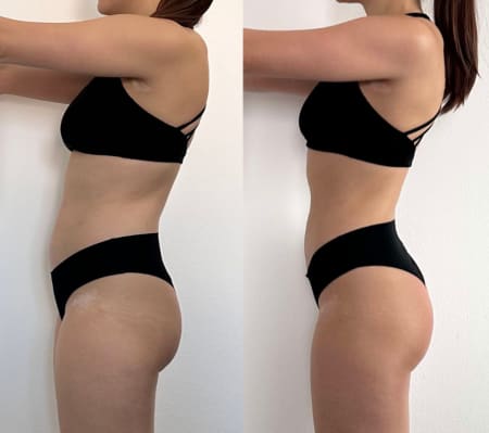 Membership transformation testimonial by Samanta